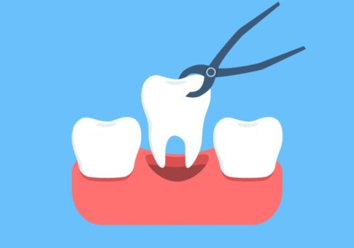 One in 15 resort to DIY dentistry, as affordability trumps access as the hot topic