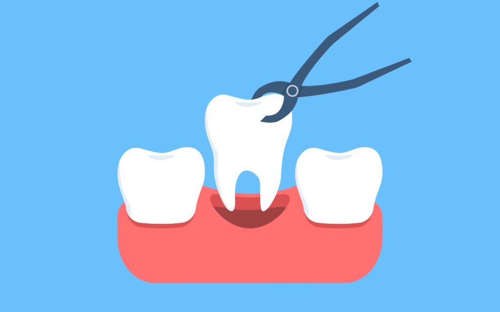 One in 15 resort to DIY dentistry, as affordability trumps access as the hot topic