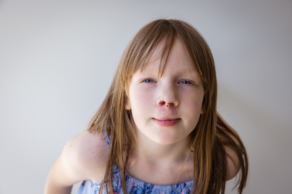 Charity backs calls for improved dental care for people with cleft