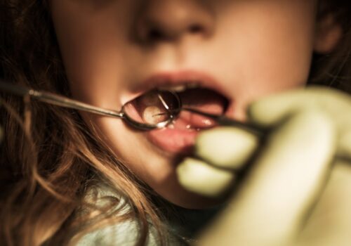 Tooth decay remains leading cause of child hospital admissions