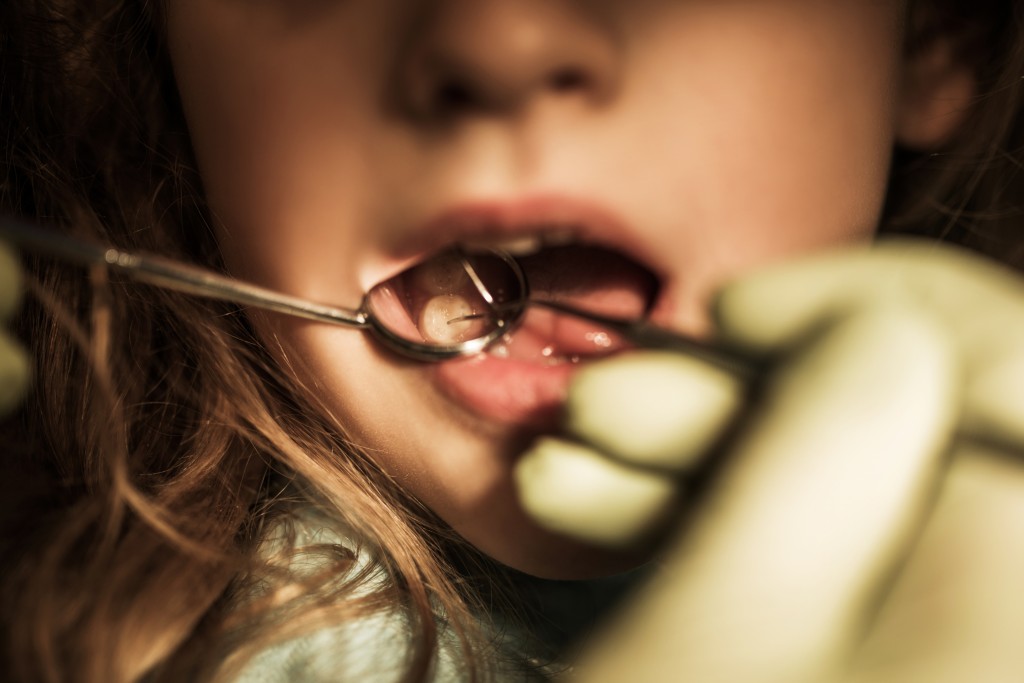 Tooth decay remains leading cause of child hospital admissions